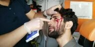 ​DİHA muhabiri polisin sıktığı gaz fişeğiyle yaralandı!